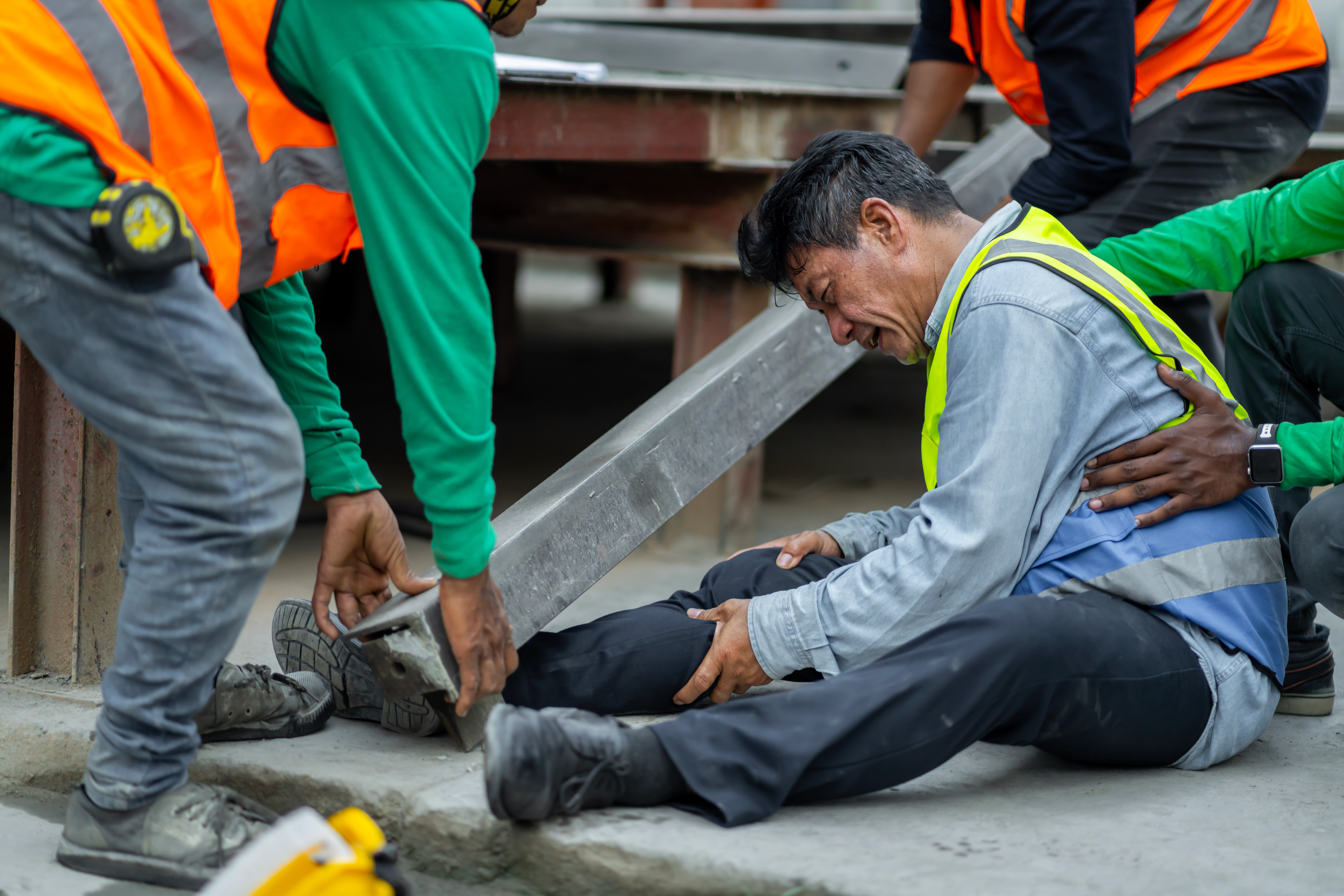 an engineer has an accident where steel falls on leg